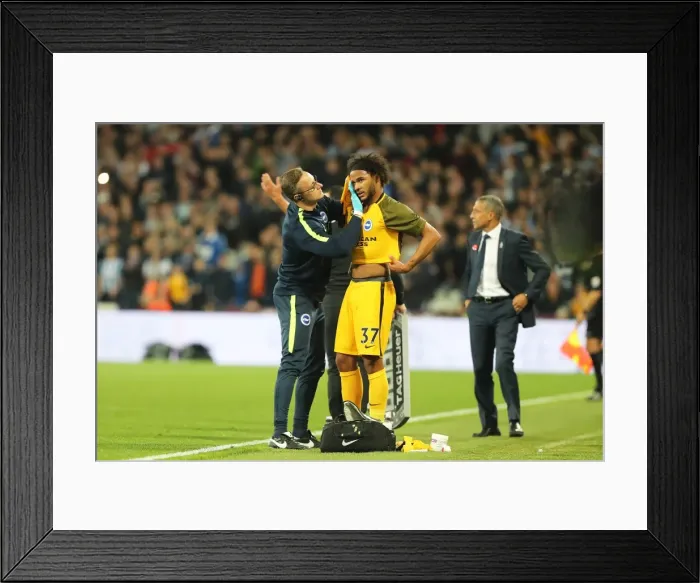 Framed Print : Brighton's Isaiah Brown Receives Treatment for Head Injury During West Ham Clash (20OCT17) Framed Print : Brighton's Isaiah Brown Receives Treatment for Head Injury During West Ham Clash (20OCT17)