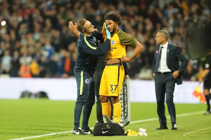 Framed Print : Brighton's Isaiah Brown Receives Treatment for Head Injury During West Ham Clash (20OCT17) Framed Print : Brighton's Isaiah Brown Receives Treatment for Head Injury During West Ham Clash (20OCT17)